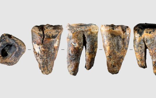 Neandertales contra el caries: encuentran la evidencia más antigua conocida de un tratamiento dental invasivo